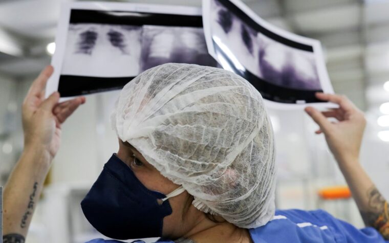 Câncer de pulmão: diagnóstico precoce é chave para melhorar prognóstico